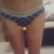 4 weeks out from skin removal from the thighs.  4 #s of skin removed!
