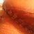 This is PO day 7 and this is my drain going into my right side.  As you can see, the scar is low and already thin