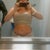 The Day After my surgery, fixing to head home...