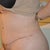 Two weeks post op.