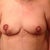 day 2 post op