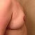 day 2 post op