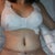 2 days post op