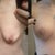 Breasts before and 4 weeks after. Crazy!