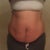 3 weeks before- front