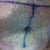 And here it is post-ops. I love that my incisions are thin.