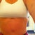 I need some scar relief for my belly button