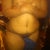 Day 15 day po tape off but very swole lower tummy, groin and right above hips