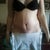 front view-23 days post op