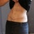 Ignore the messy mirror.  This is about 30wks (7 1/2 months) post surgery.  I have sutures from the dog ear revision.  Pretty pleased overall.
