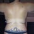 A picture of my back boobs!  haha