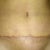 3 weeks post op (first post op pic I dared to snap)