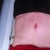 Front 4 weeks po