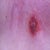 Oooky belly button needs to heal!