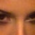 2 days after Juvederm- looking down, with only a little bit of concealer on. Very happy!