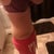 4 months post op