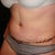 So weird to see a flat belly - despite the swelling that is still there!