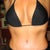 2 weeks post-op