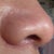 pictures of the scar
