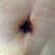 New belly button close up