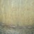 Recent picture of my incision.  Very thin low and this only one month.  In 6 months I'm sure it will look great.