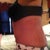 Like my new tummy .. Still has swelling