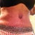 BB still has swelling around it