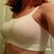 1 1/2 weeks post op