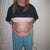 BEFORE SMART LIPO