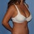 After - stretch marks are gone and skin is tight and youthful