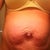 My before picture. So awful with diastasis and wrinkled skin. Wouldn't even let my husband see this.