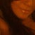 Feb 2011 after Micro-Dermabrasion and Laser Genesis first treatment
and off course one full year under Dermatology care and Acne medications.