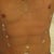 Applying natural homeopathic healing cream to incision sights.