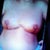 8 days watch in purple spot left under nipple