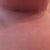 Righty Day 21.  You can see the outline of the scar strip.