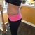 Taken two days before surgery {Left Side}