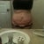 Day before surgery, front: wondering what 115 pounds of weight loss can do? Well here ya go! I don't recommend the weight gaining part.