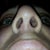 Nose 1 wk