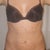 Before (after my pre-op with markups)