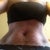My loose skin.