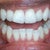 Note my upper right incisor especially.
