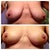2 weeks before and after