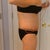 4 Days Post Op