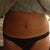 Same evening of lipo (post op.)