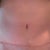 12 weeks post op