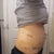 looks a little bit more swollen from this angle compared to day 8... this is day 12