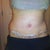 12day po.. starting to see some definition