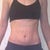 Pre-op (not flexing) Lots of loose skin.  Looked much worse in real life than in this pic