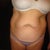 Wow, seeing my stomach like this is hard to stomach.