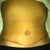 I do like my scars and belly button.